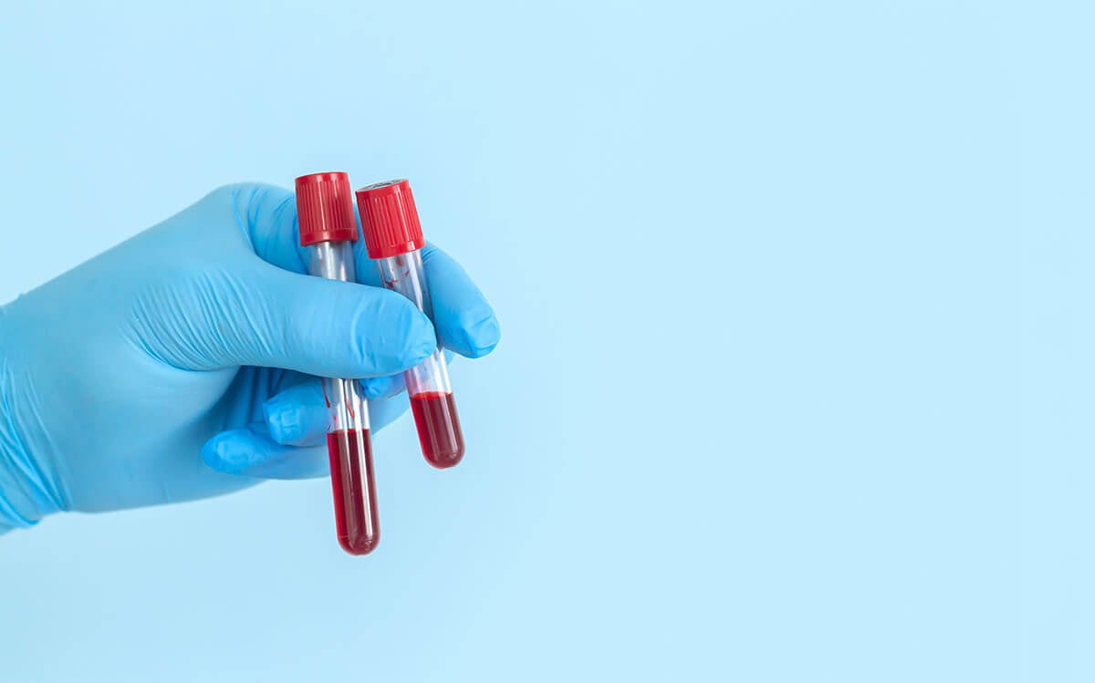 badanie krwi psa wyniki