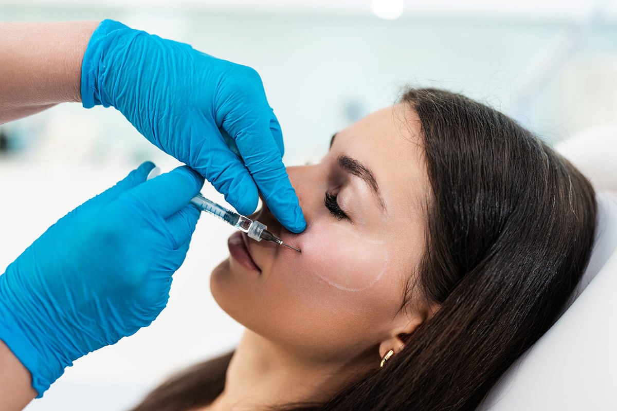 kwas hialuronowy medycyna estetyczna