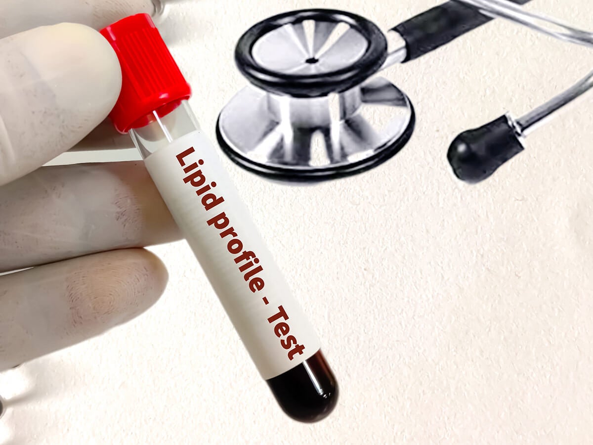 lipidy krew