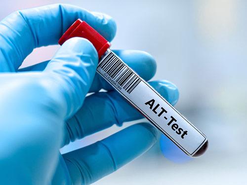 Podwyższone ALT – co to jest? Normy, badanie
