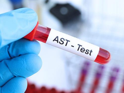 Podwyższone AST – co to jest? Normy, badanie