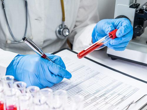 Podwyższone GGTP - co to jest? Normy, badanie