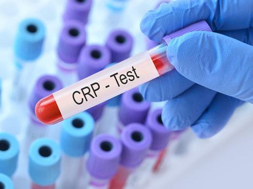 Wysokie CRP - co to jest? Norma, badanie