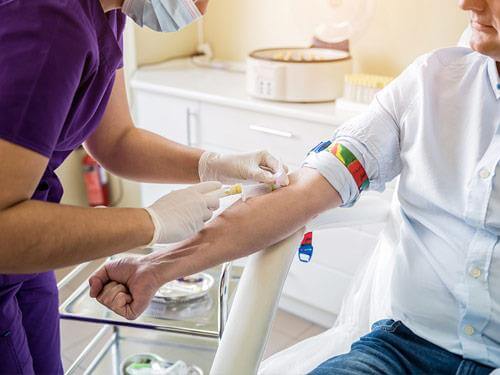 Badanie PSA – co to jest?