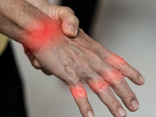 Reumatoidalne zapalenie stawów – przyczyny, objawy