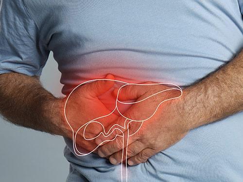 Stłuszczenie wątroby - objawy, leczenie, przyczyny