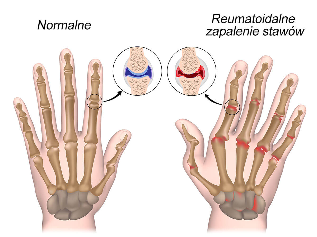 rzs por&oacute;wnanie
