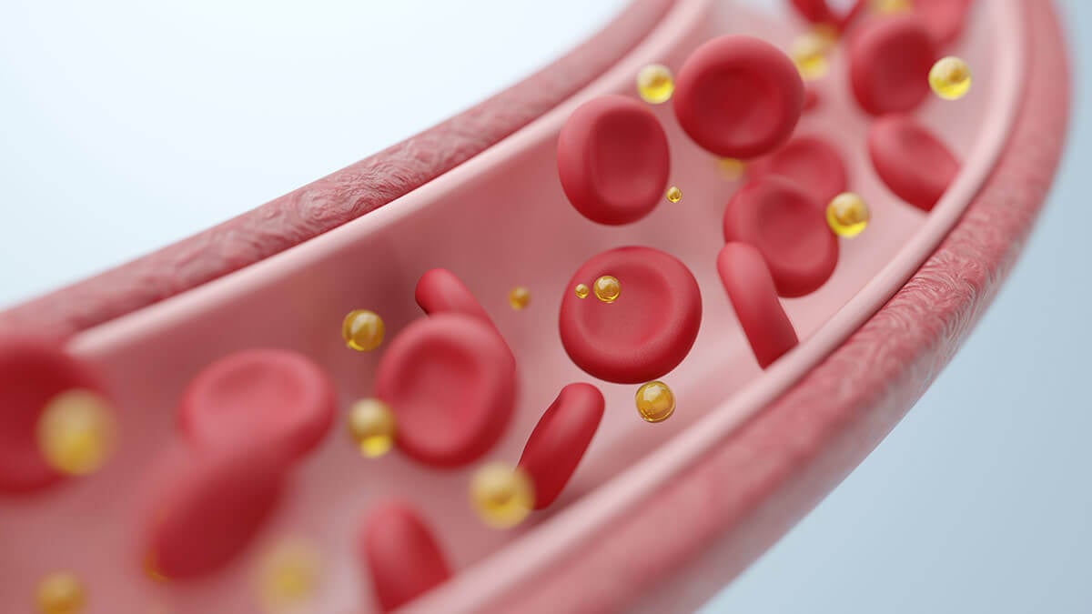 tr&oacute;jglicerydy